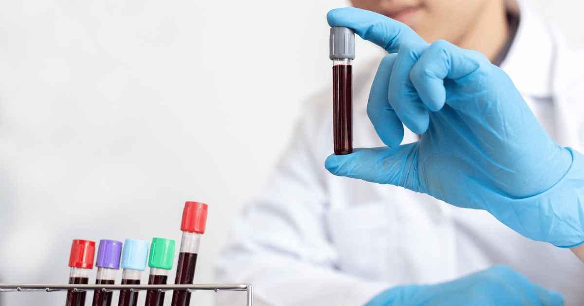 Imagen de un especialista de laboratorio realizando una prueba de embarazo en sangre en Mérida Yucatán.